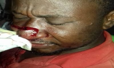 Police search for assailant of PDS staff at Kokrobite