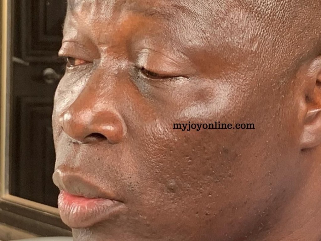 Nii Lante Vanderpuye Allegedly Assaulted [Photo]