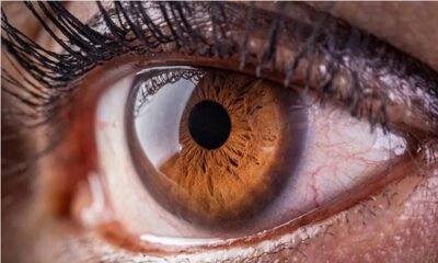Eye Infections Are More Likely When There Is Environmental Pollution: GOA Warns