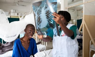 HIV Patients Compelled To Stop Therapy Due To Out-of-Pocket Costs
